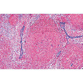 LIEDER Histologie: Lymphsystem 6 Mikropräparate