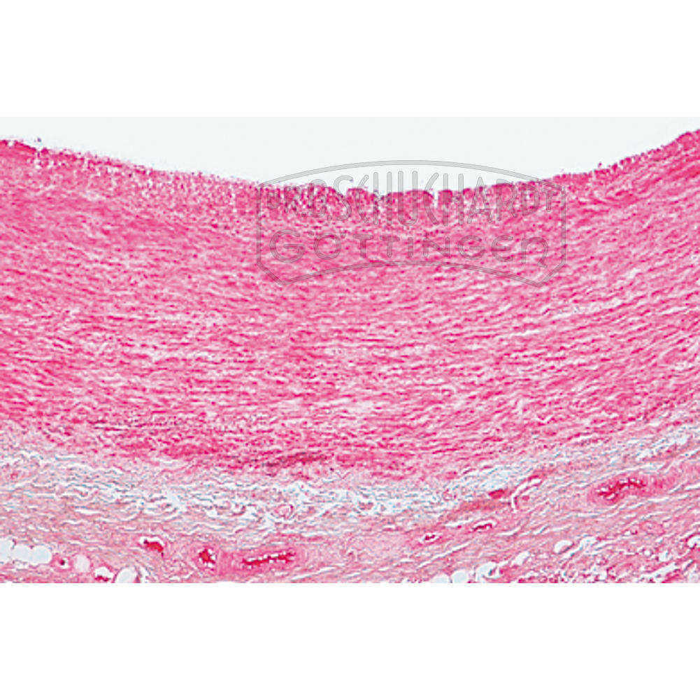 LIEDER Histologie: Kreislaufsystem 8 Mikropräparate