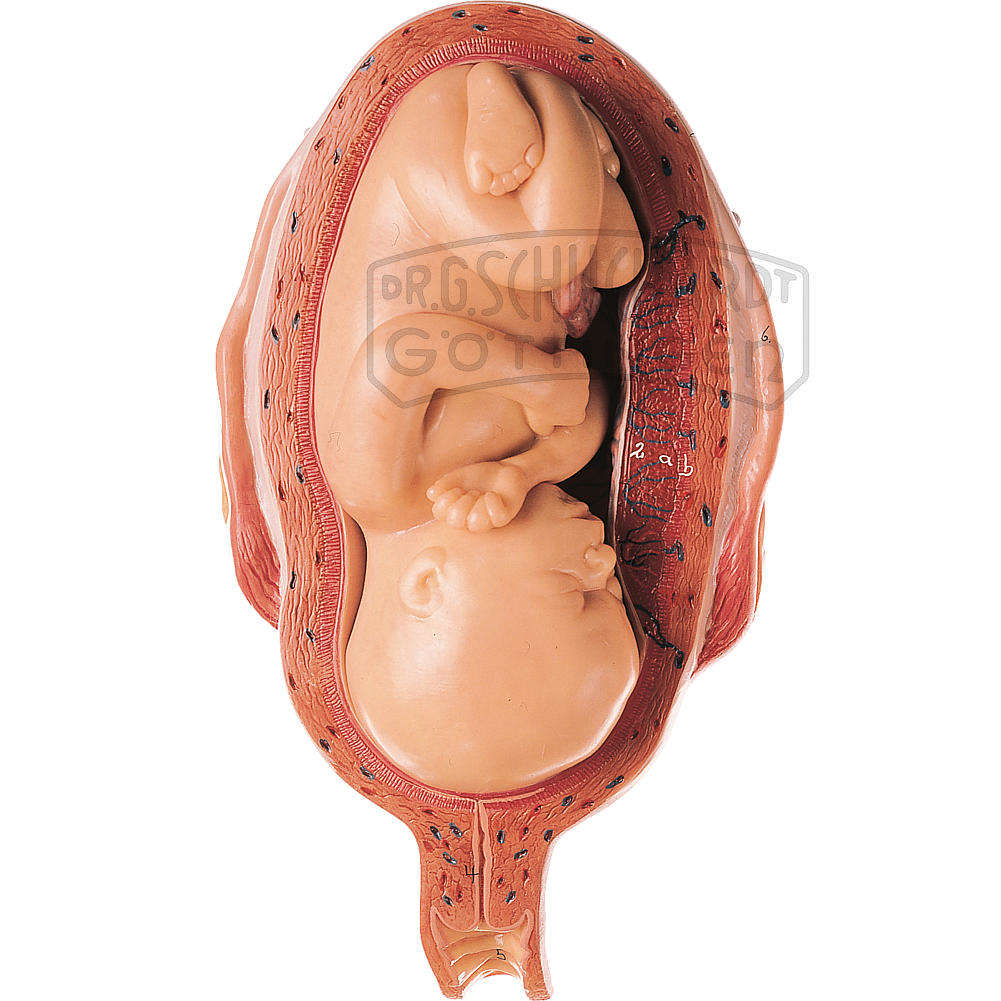 Uterus mit Fetus im 7. Monat Modell SOMSO®