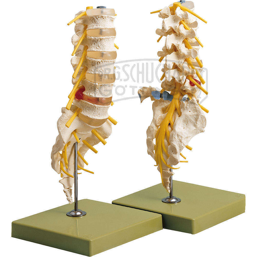 Lendenwirbelsäule Modell SOMSO®