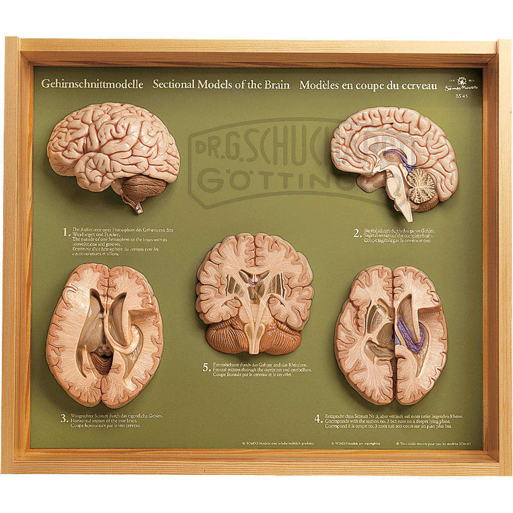 Gehirnschnittmodelle 5-teilig Modell SOMSO®