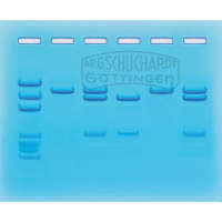 COVID-19 Testung mittels PCR