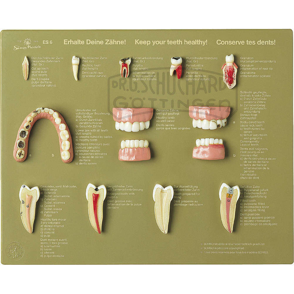 Schaukasten "Erhalte Deine Zähne" SOMSO®
