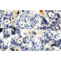Mitochondrien in den Zellen von Leber oder Niere