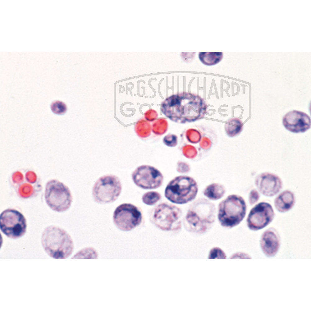 Saccharomyces cerevisiae, Hefepilze, Zellen in Sprossung