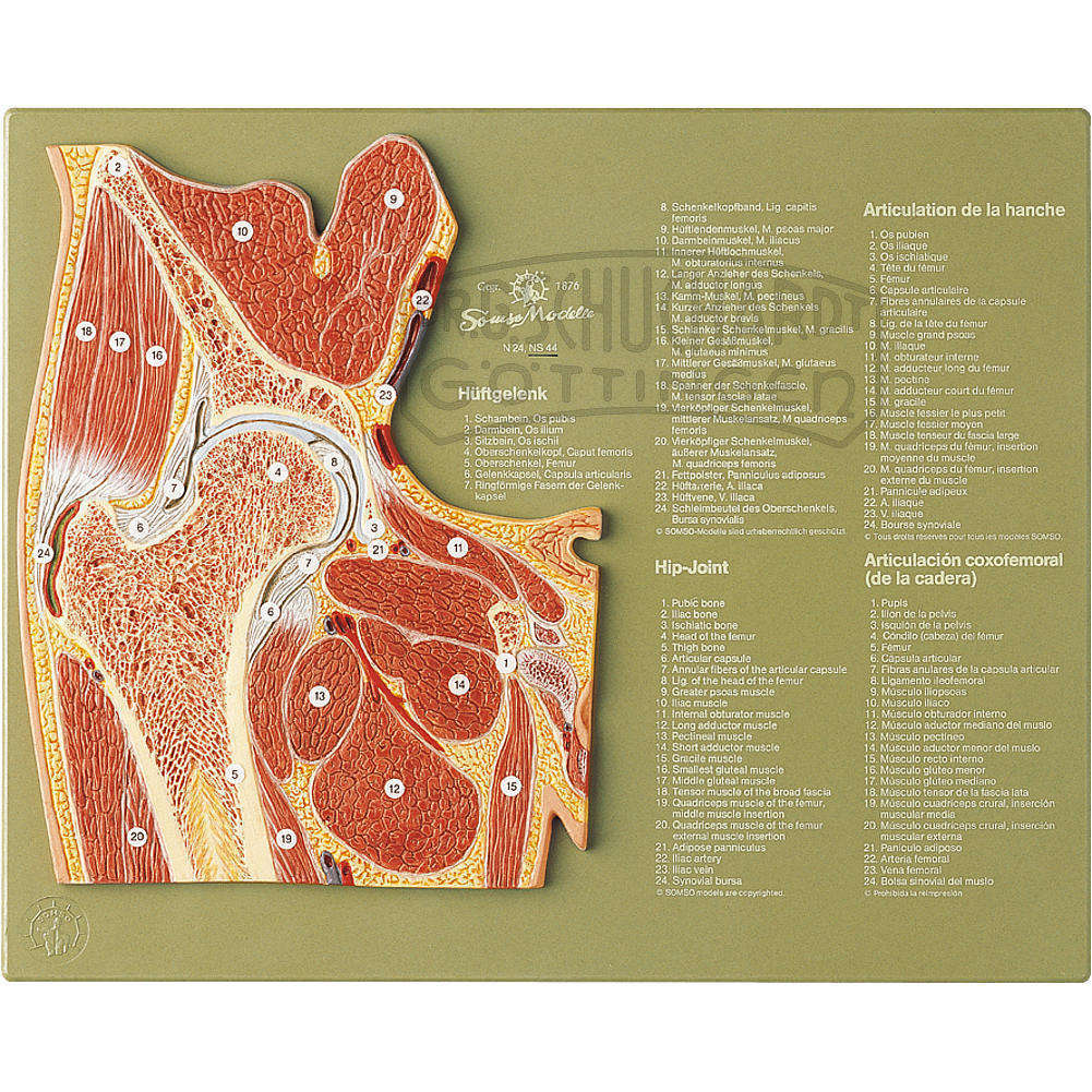 Gelenkschnitt "Hüftgelenk" Modell SOMSO®