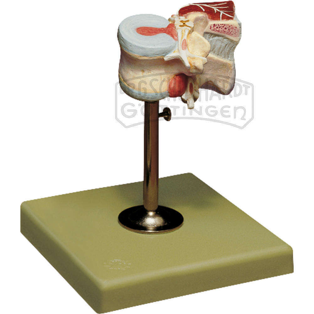 Erster Lendenwirbel mit Bandscheiben & Rückenmuskulatur Modell SOMSO®