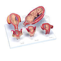 Schwangerschaftsserie 5 Modelle DeLuxe