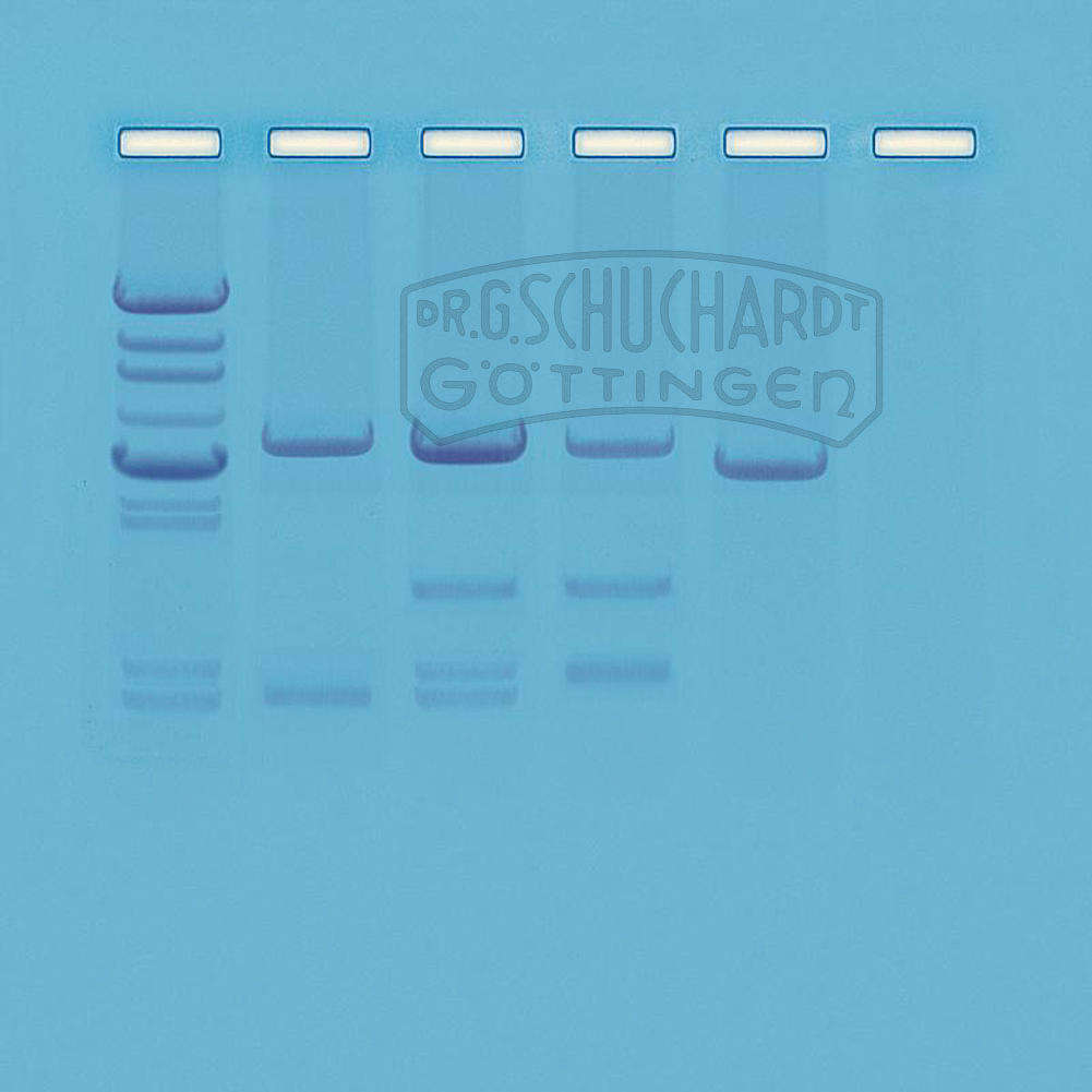 DNA Vaterschaftsanalyse mittels Polymerasekettenreaktion