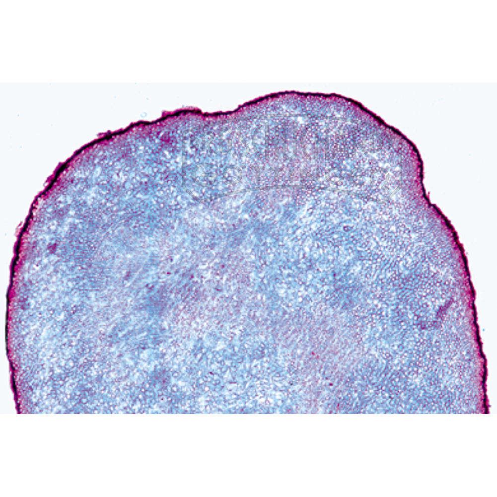 Claviceps purpurea, Mutterkorn, Sklerotium quer