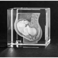 3-D-Modelle in Glas, Unterleib mit Baby